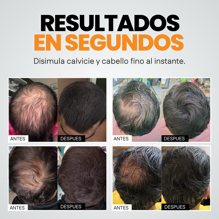 Kit con Aplicador Profesional de Fibras Capilares