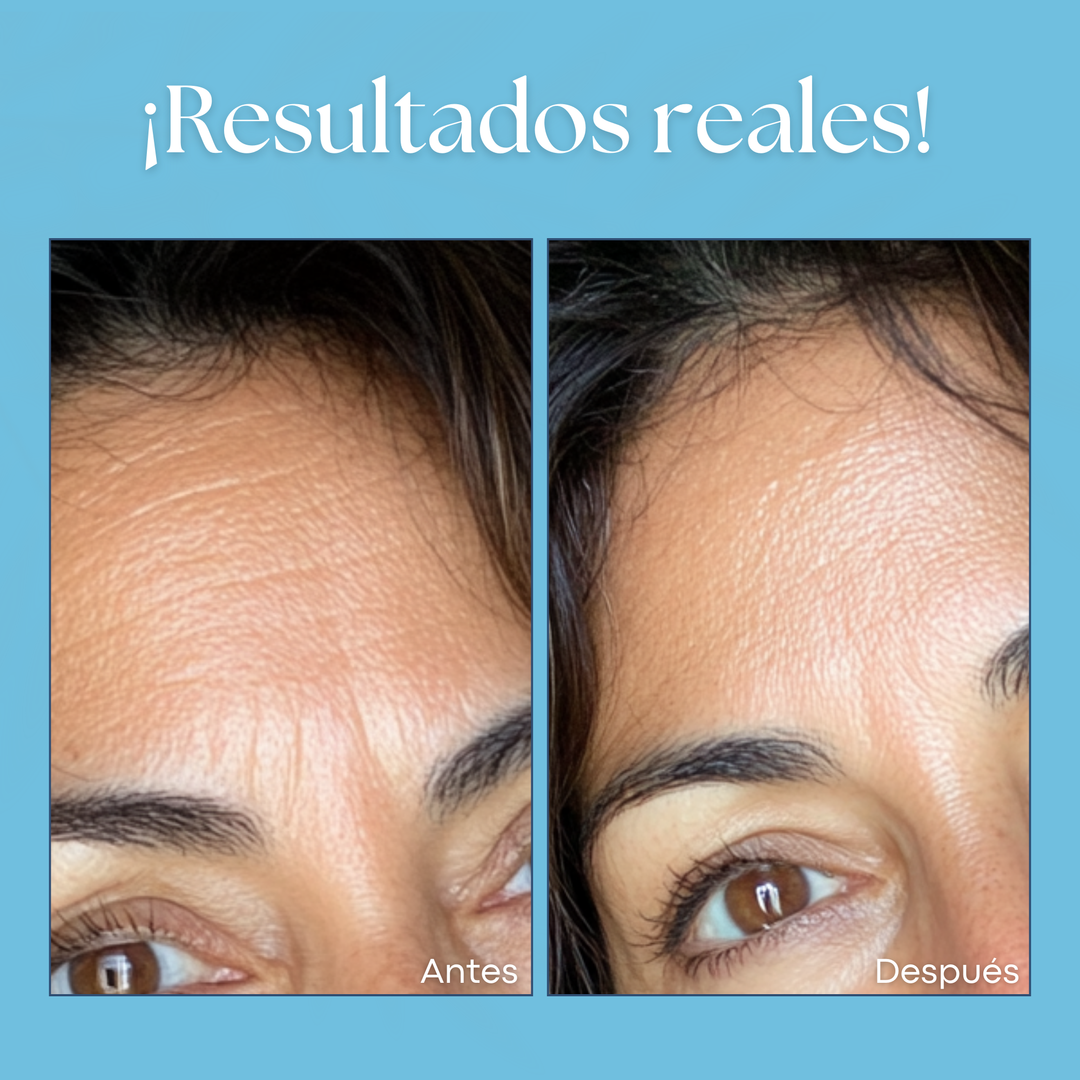 Serum Ácido Hialurónico