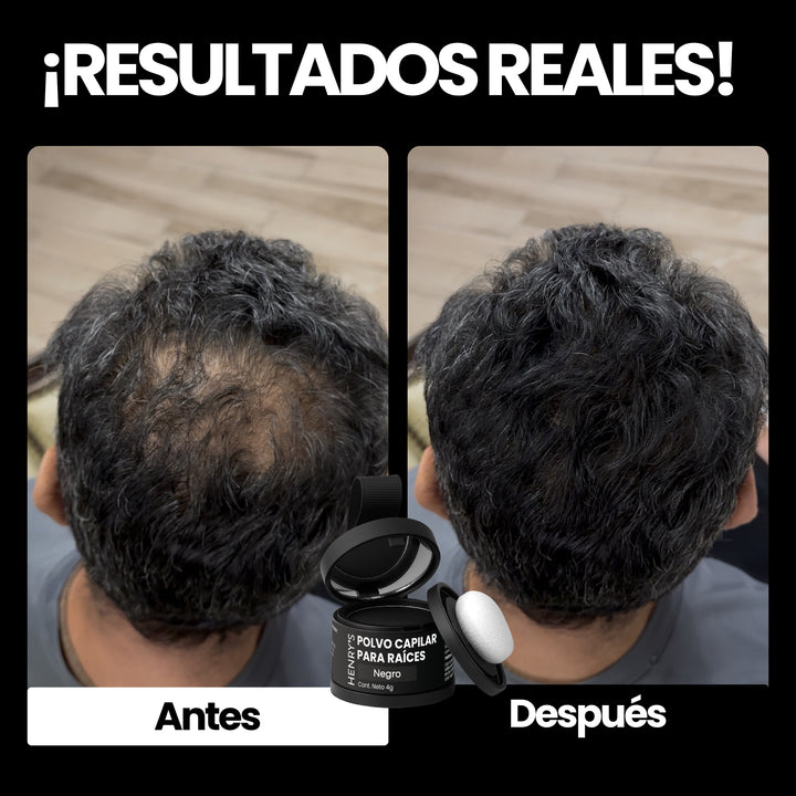 Polvo para Cubrir Raíces